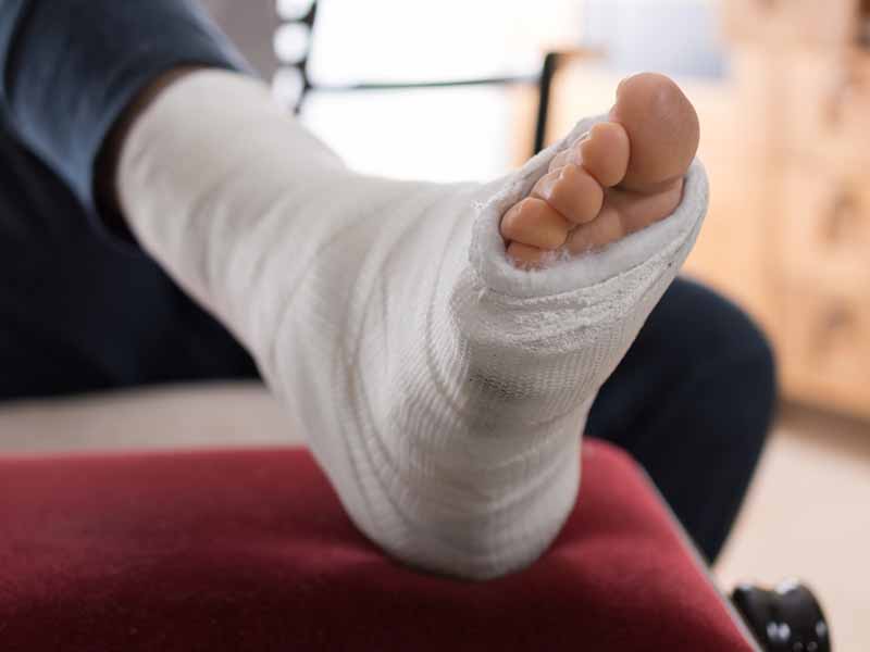 foot in cast propped up on furniture