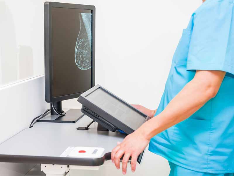 Radiology tech viewing mammogram