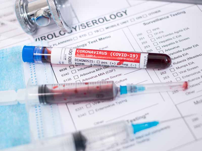 covid test blood samples