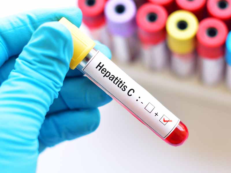 test vial for hepatitis C