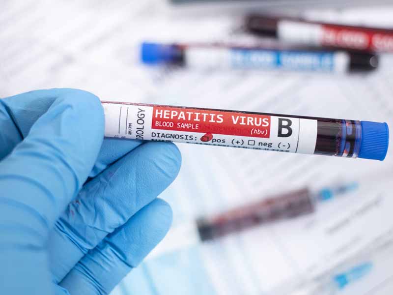 hepatitis B virus blood test