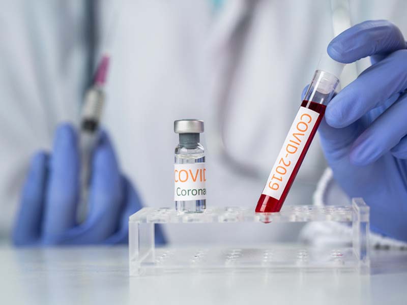 Doctor holding test tube with blood for COVID-19 test
