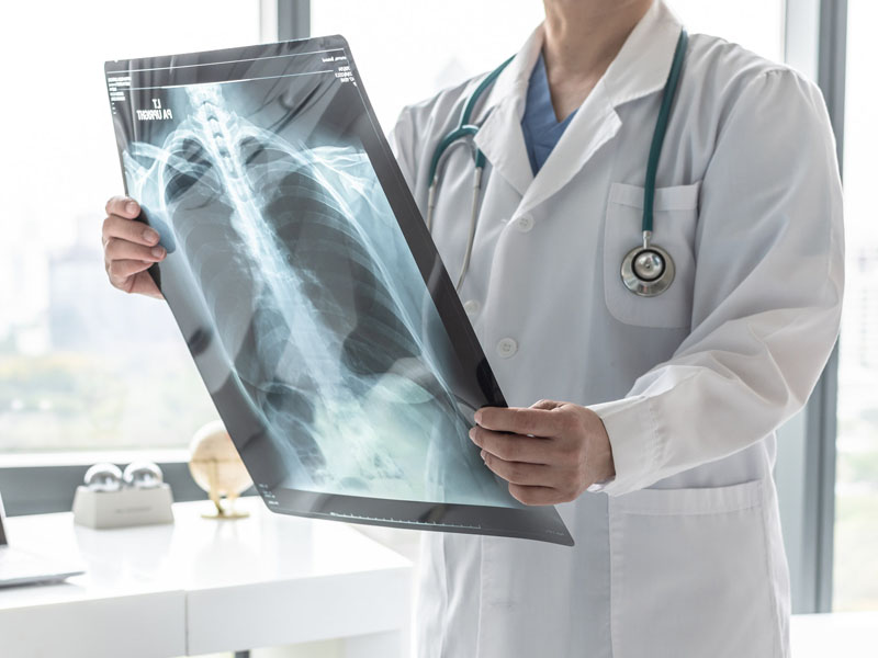 physician looking at X-ray