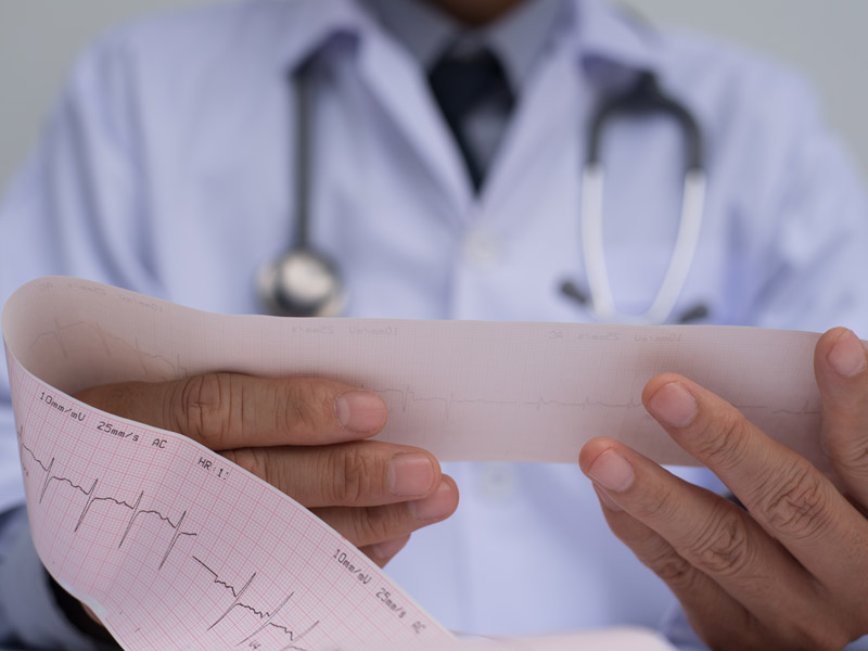 Doctor holding an EKG print-out