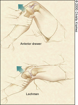 The Rules of Four: A Systematic Approach to Diagnosing Common  Musculoskeletal Conditions of the Knee