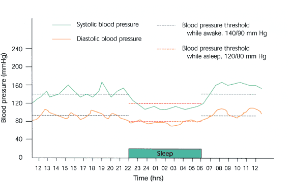 Ambulatory Blood Pressure Monitoring