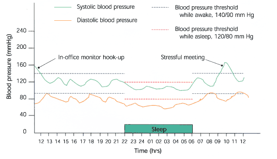 Ambulatory Blood Pressure Monitoring - Heart and Vascular Clinic