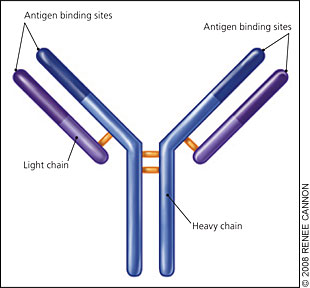 Multiple Myeloma: Diagnosis | AAFP