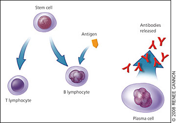 Multiple Myeloma: Diagnosis and Treatment | AAFP