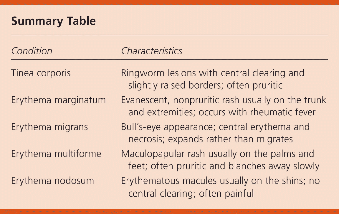 Rash And Fever In A College Student Aafp