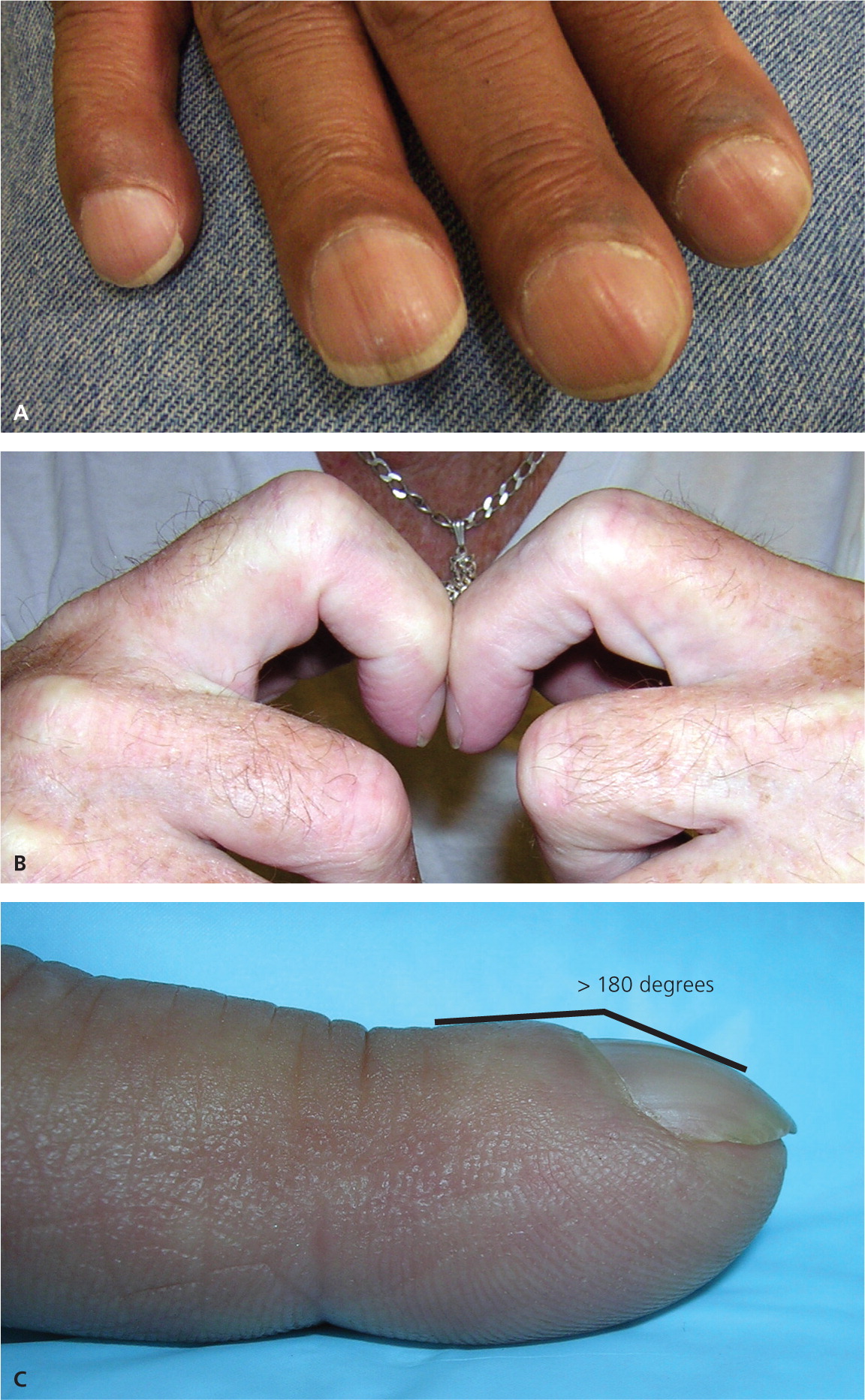 A Guide To Detecting Nail Pathology