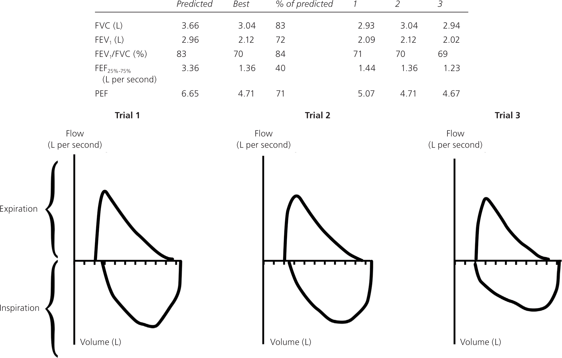 Spirometry Test Results