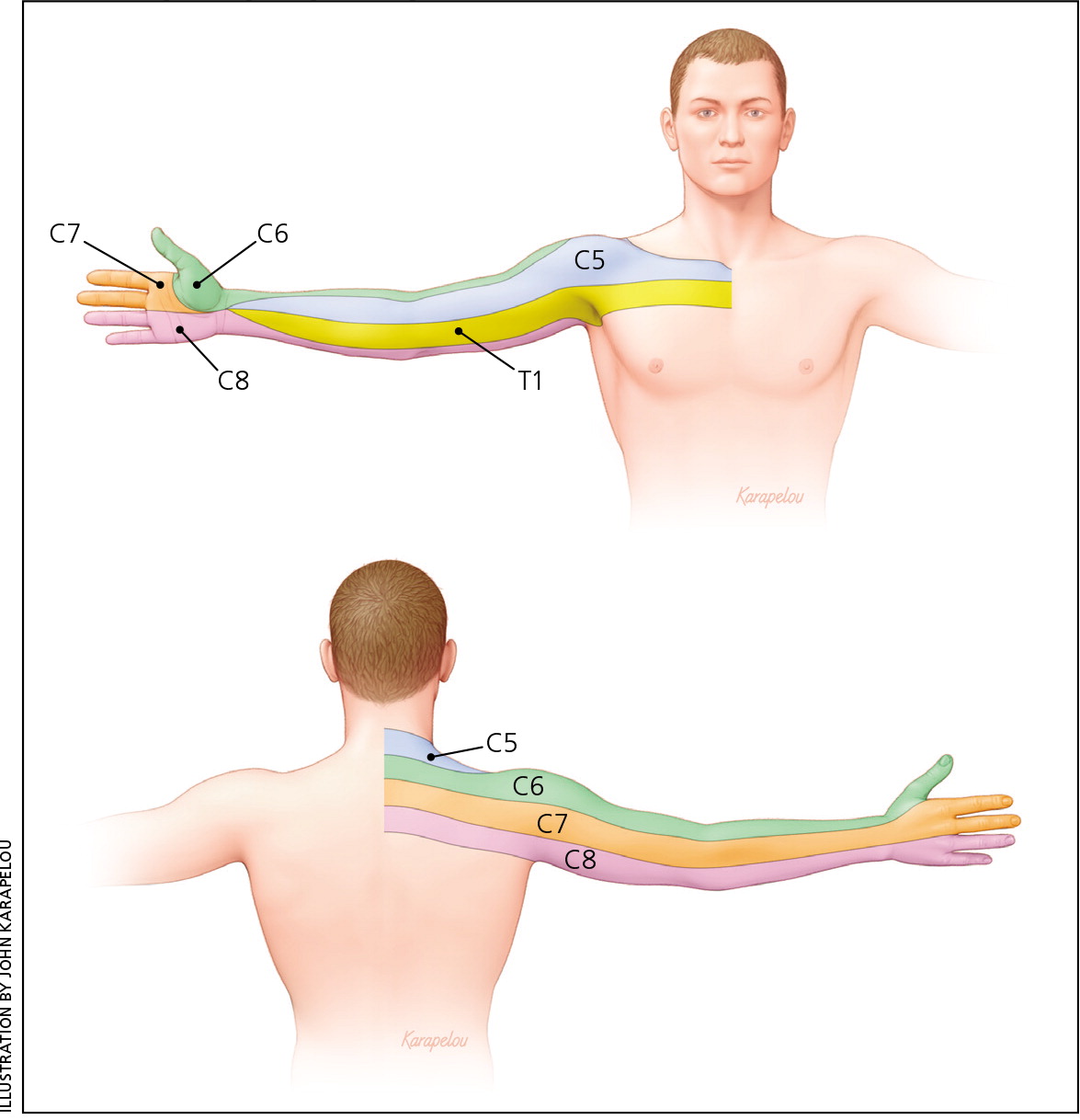 kim Regan klæde Nonoperative Management of Cervical Radiculopathy | AAFP