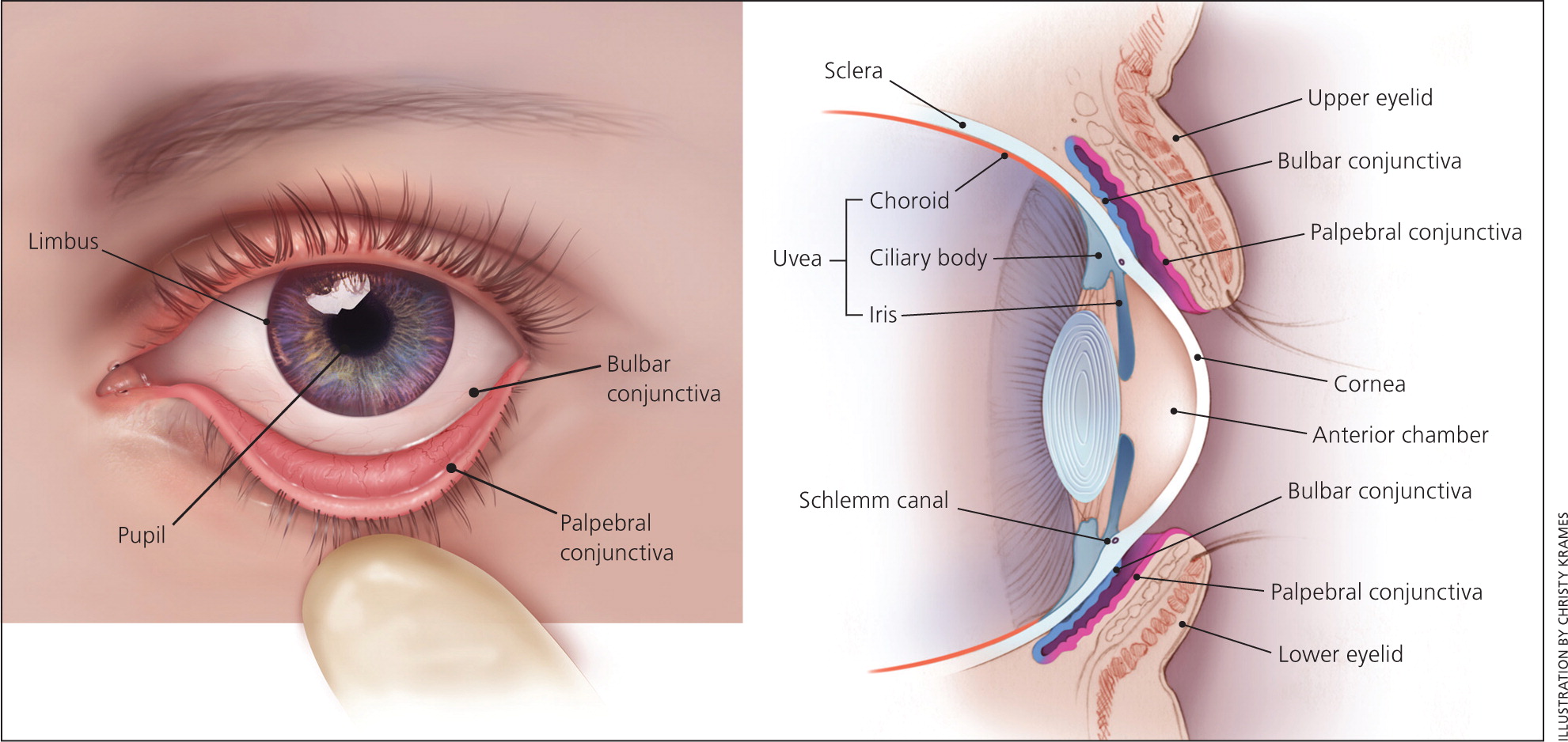 clinical problem solvers vision loss