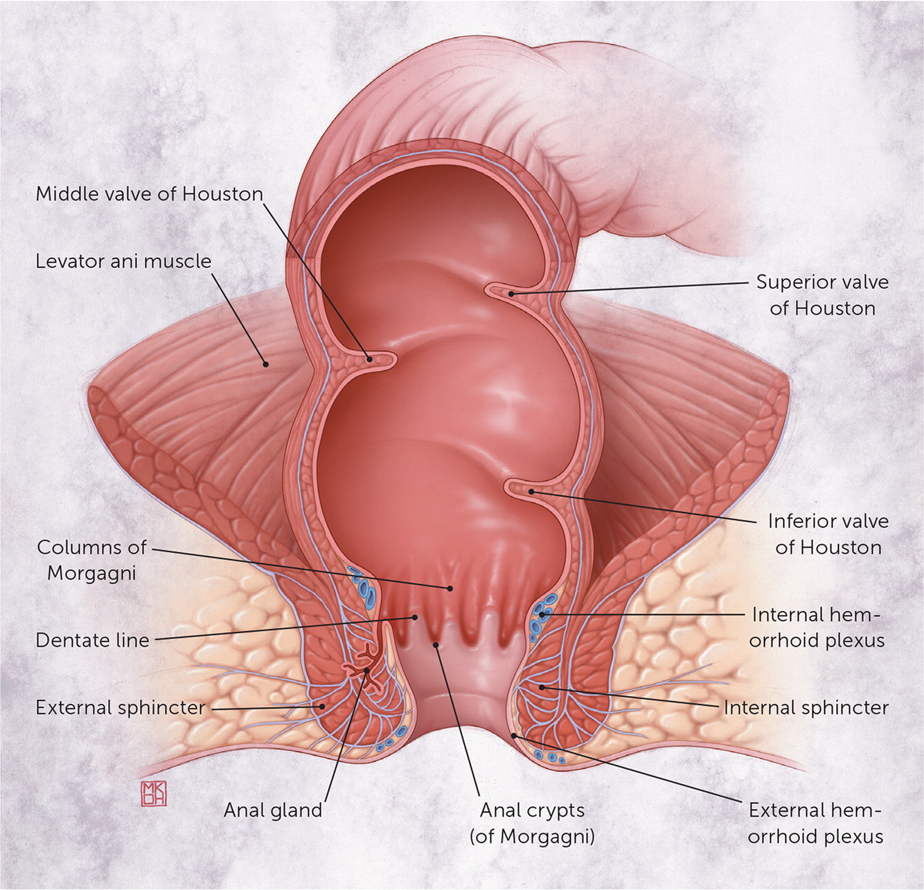 The single pile classification: a new tool for the classification of  haemorrhoidal disease and the comparison of treatment results