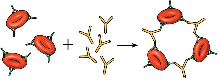 case study on hemolytic anemia