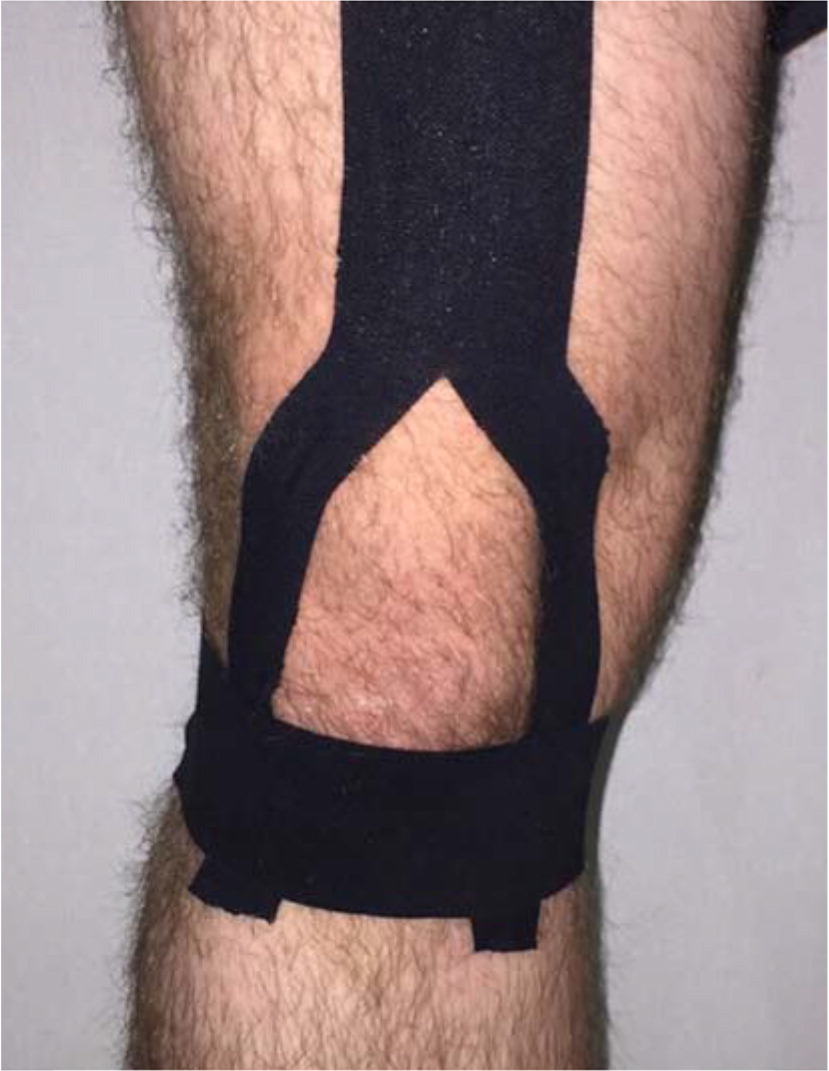 How to apply Kinesiology tape for knee pain - Patella Femoral Syndrome /  Osgood Schlatters Syndrome 