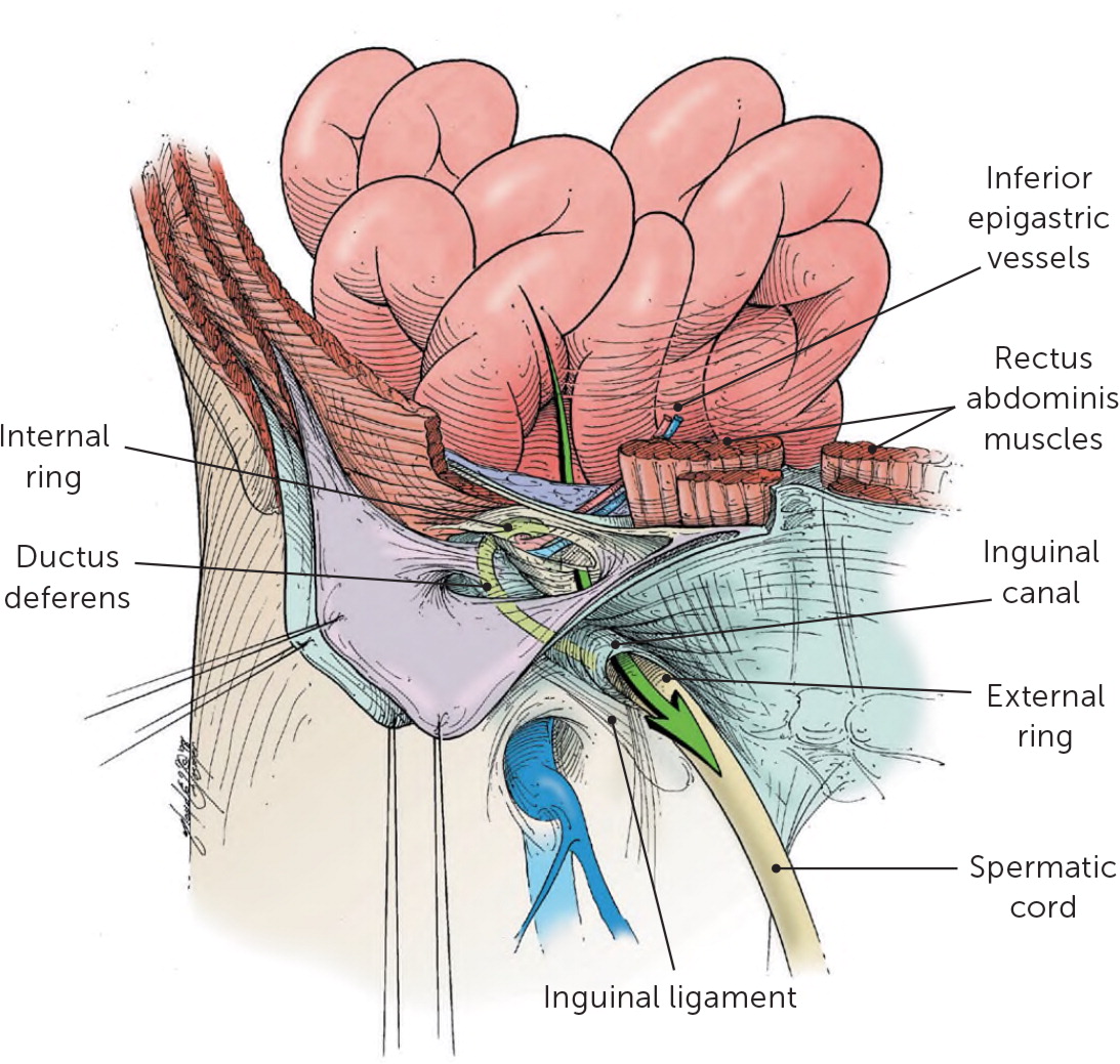 Inguinal Canal: Anatomy and Hernias | Concise Medical Knowledge