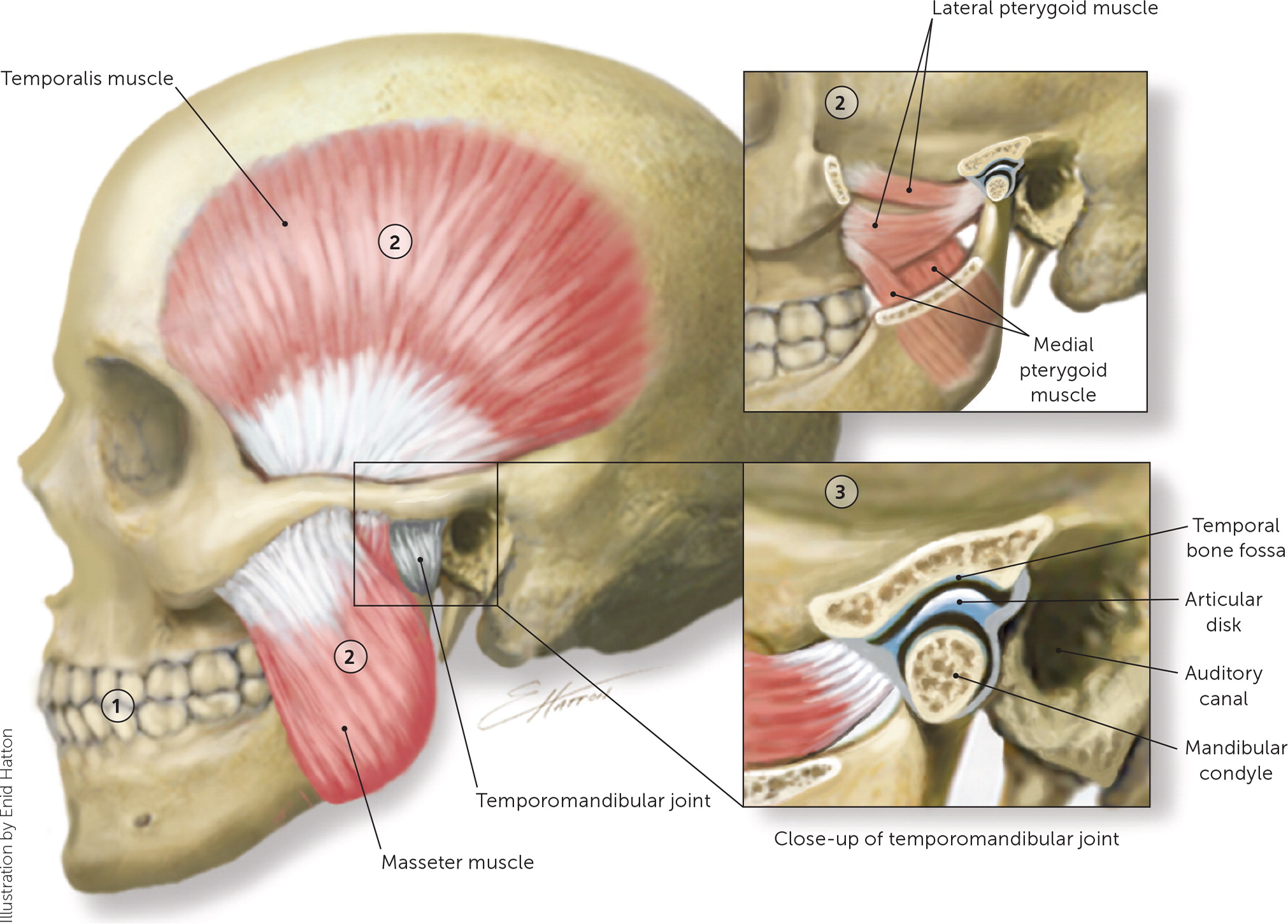 Внчс уха. Мышцы и связки височно-нижнечелюстного сустава. Мышцы височно-нижнечелюстного сустава анатомия.