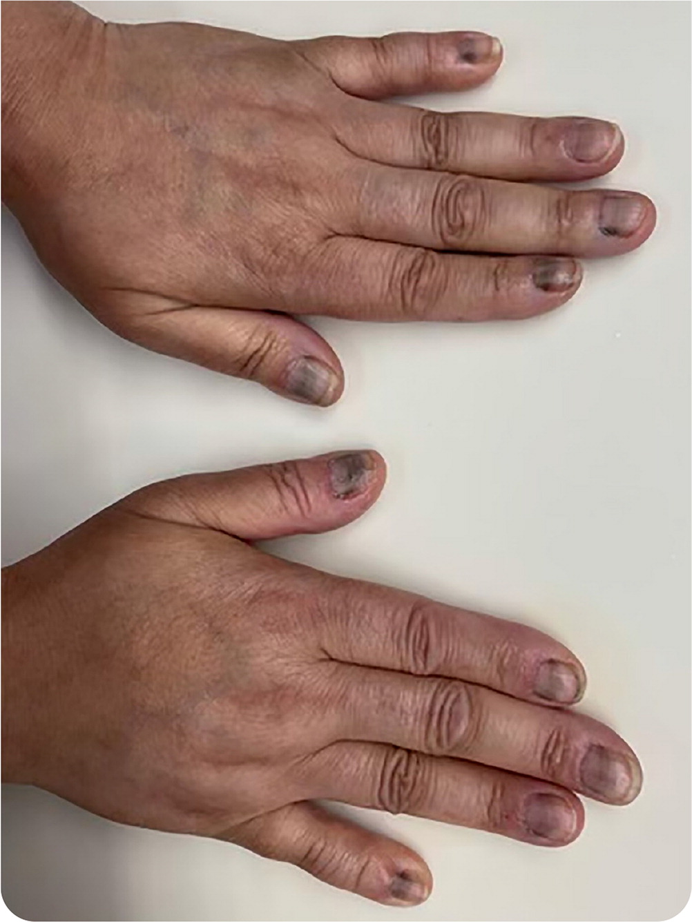 Fingers of a Woman Wearing a Black Nail Polish · Free Stock Photo