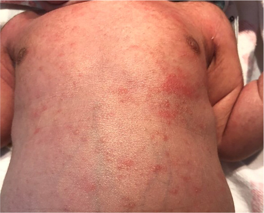 clinical presentation of syphilis infection