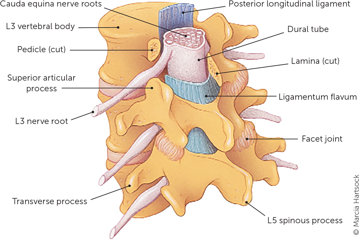 spondylolisthesis symptoms lumbar