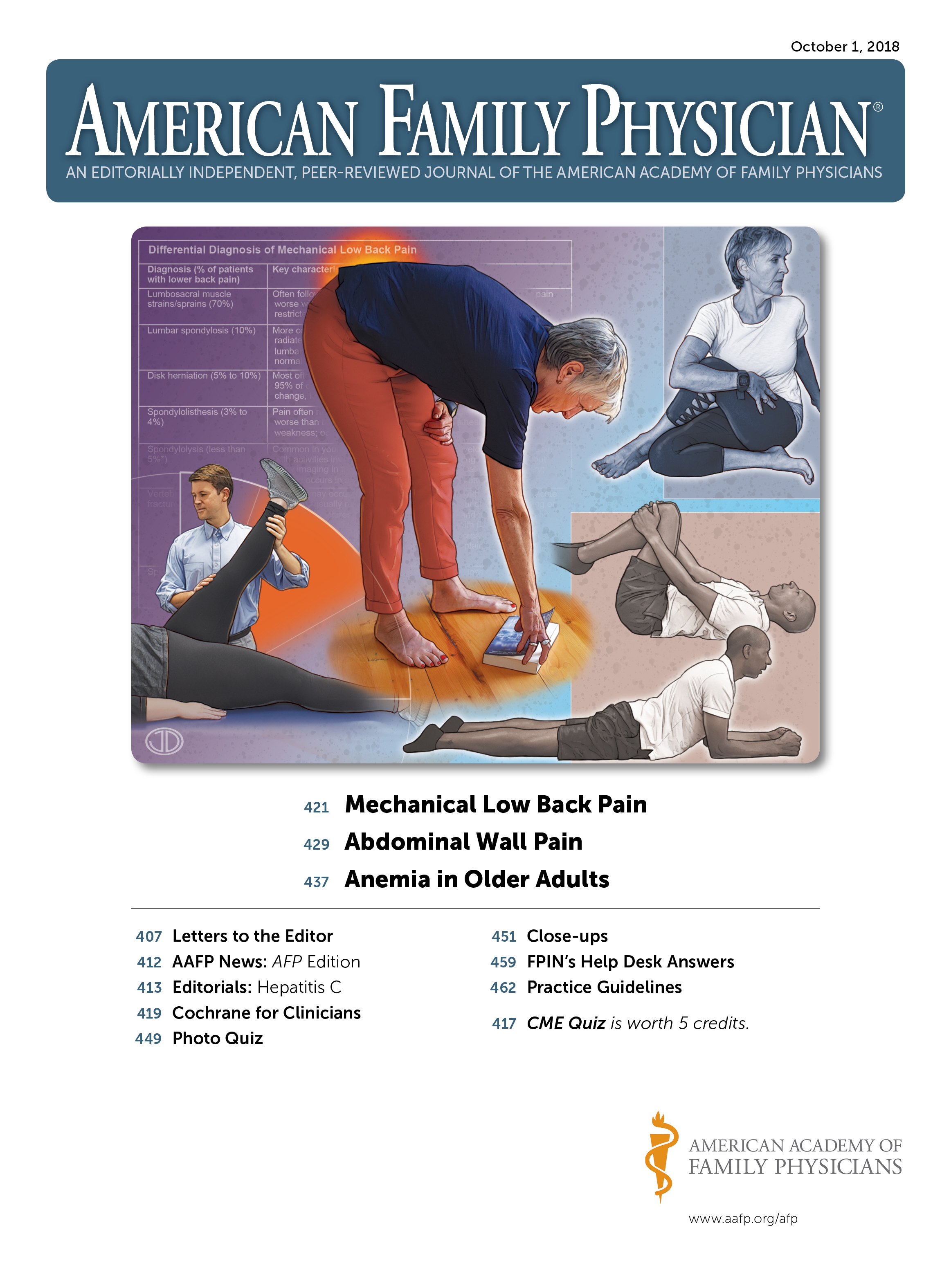 Inspirere Ingen måde kanal Mechanical Low Back Pain | AAFP