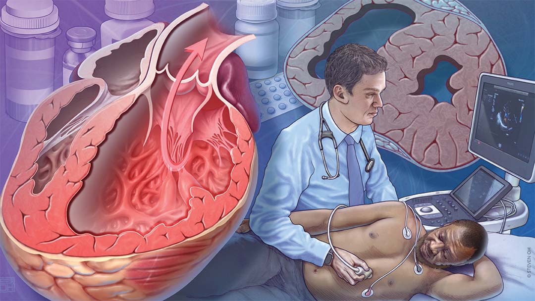 Heart Failure With Reduced Ejection Fraction: Medical Management